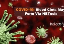 Blood Clots In COVID-19 Patients Due To NETosis : New Study Blood Clots May Form via NETosis