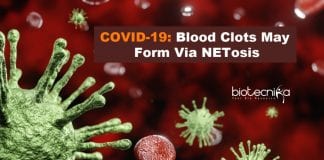 Blood Clots May Form via NETosis