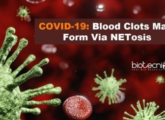 Blood Clots In COVID-19 Patients Due To NETosis : New Study Blood Clots May Form via NETosis