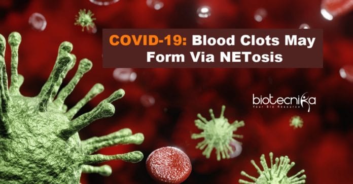 Blood Clots May Form via NETosis