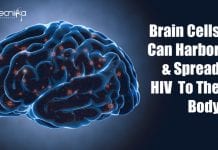 Brain Cells Can Harbor & Spread HIV Virus To The Body Brain cells can harbor HIV