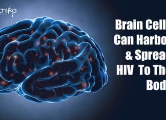 Brain cells can harbor HIV