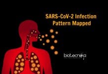SARS-CoV-2 Infection Pattern In Respiratory Tract Mapped COVID-19 Infection Pattern
