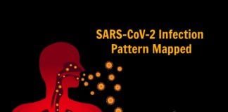 COVID-19 Infection Pattern