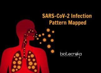SARS-CoV-2 Infection Pattern In Respiratory Tract Mapped COVID-19 Infection Pattern