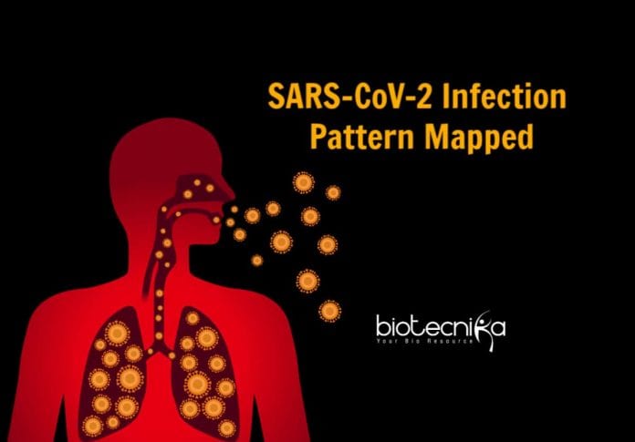 COVID-19 Infection Pattern