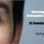 Device to detect diabetic retinopathy