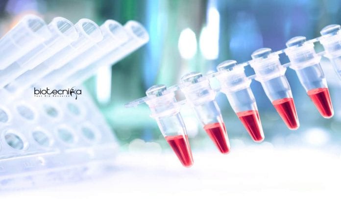 JNU PhD Job Opening
