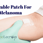 Wearable patch for melanoma