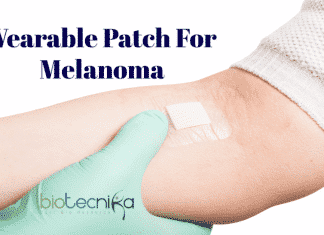 Wearable patch for melanoma