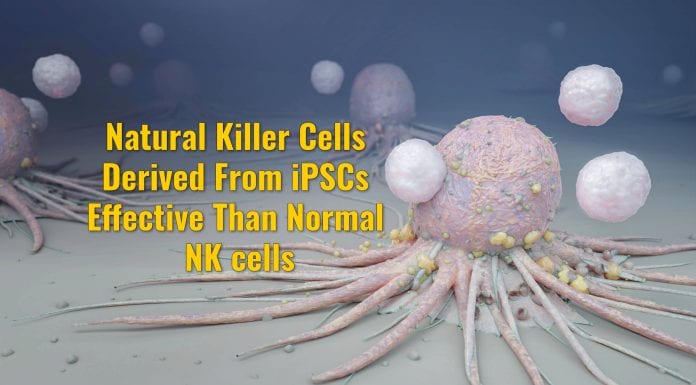 natural killer cells from iPSCs