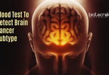 Highly Sensitive Non Invasive Blood Test To Determine Brain Cancer Subtype blood test for brain tumors