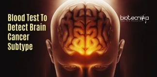 blood test for brain tumors