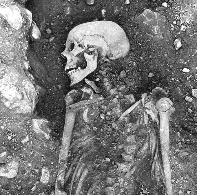 Smallpox virus in Viking skeletons