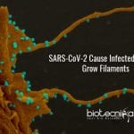 filopodia in coronavirus infected cells