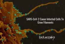 SARS-CoV-2 Cause Infected Cells To Sprout Filaments That May Spread The Virus filopodia in coronavirus infected cells