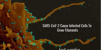 filopodia in coronavirus infected cells