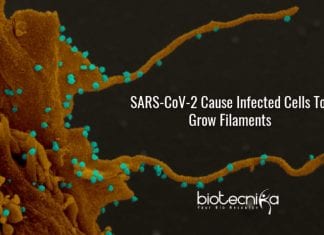 filopodia in coronavirus infected cells