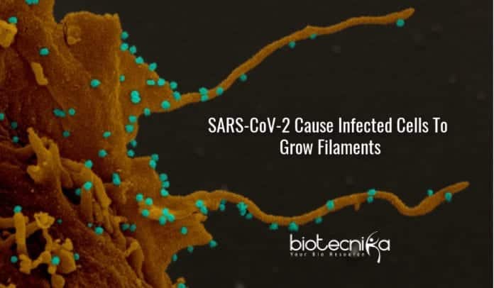 filopodia in coronavirus infected cells