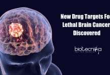 Scientists Discover New Drug Targets For Lethal Brain Cancer New Drug Targets for Glioblastoma