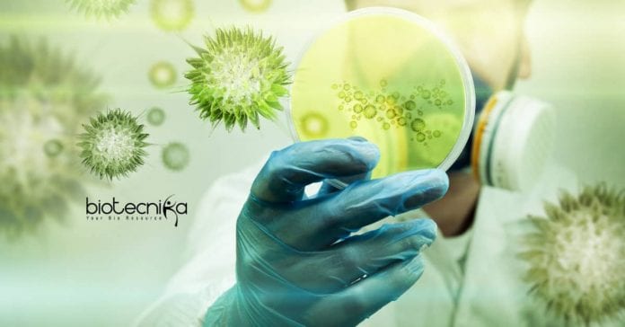 ICAR-NIVEDI Biotech