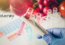 PGIMER Food Technology Dietary Lab Supervisor Recruitment PGIMER Food Technology