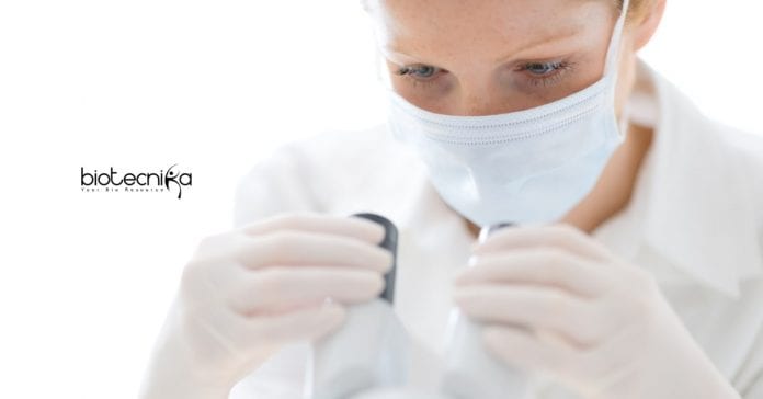 RCB Life Sciences Project