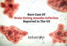 Rare Case Of Brain-Eating Amoeba Infection Reported In Florida Rare Case Of Brain-eating Amoeba