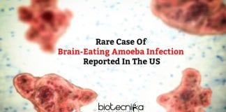 Rare Case Of Brain-eating Amoeba