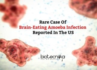 Rare Case Of Brain-eating Amoeba
