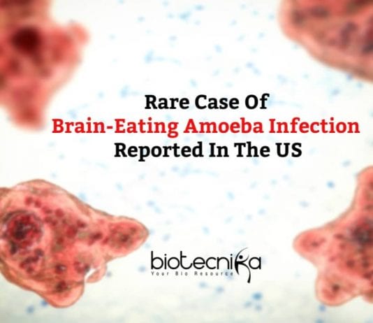 Rare Case Of Brain-eating Amoeba