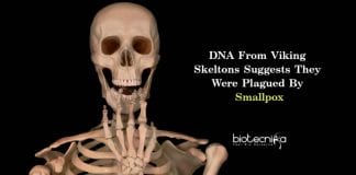 Smallpox Virus In Viking Skeletons