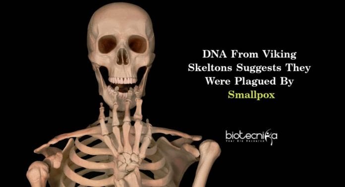 Smallpox Virus In Viking Skeletons