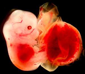 Causes for oversized placentas in cloning