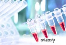 Indraprastha University BIRAC Funded Project Associate Job Opening Indraprastha University Latest Jobs