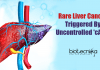 Uncontrolled Production Of cAMP Causes Liver Cancer : UC San Diego Research Rare Liver Cancer Triggered