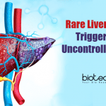 Rare Liver Cancer Triggered