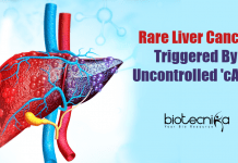 Uncontrolled Production Of cAMP Causes Liver Cancer : UC San Diego Research Rare Liver Cancer Triggered