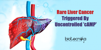 Rare Liver Cancer Triggered