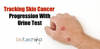 Tracking skin cancer with urine