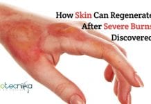 Scientists Discover Way to Regenerate Skin After Severe Burns How skin regenerate after severe burns