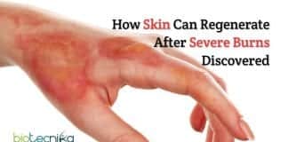 How skin regenerate after severe burns