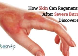 How skin regenerate after severe burns