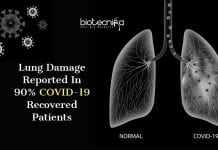 90% COVID-19 Recovered Patients In Wuhan Have Lung Damage : New Reports lung damage in COVID-19 recovered