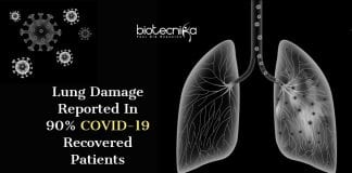 lung damage in COVID-19 recovered