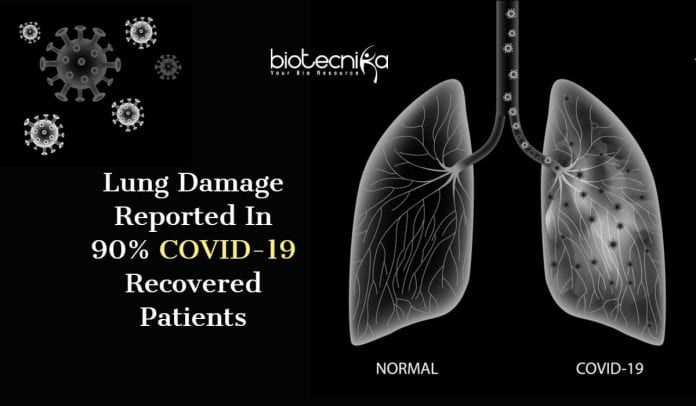 lung damage in COVID-19 recovered