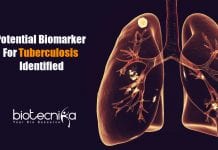 DBT-NIBGM Scientists Identifies Potential Biomarker For Tuberculosis potential biomarker for tuberculosis