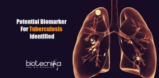 potential biomarker for tuberculosis