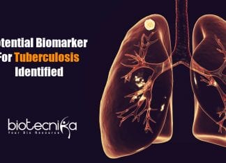 potential biomarker for tuberculosis