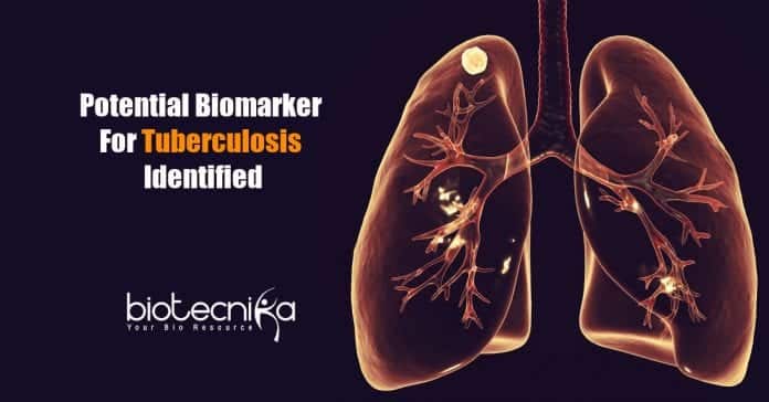 potential biomarker for tuberculosis